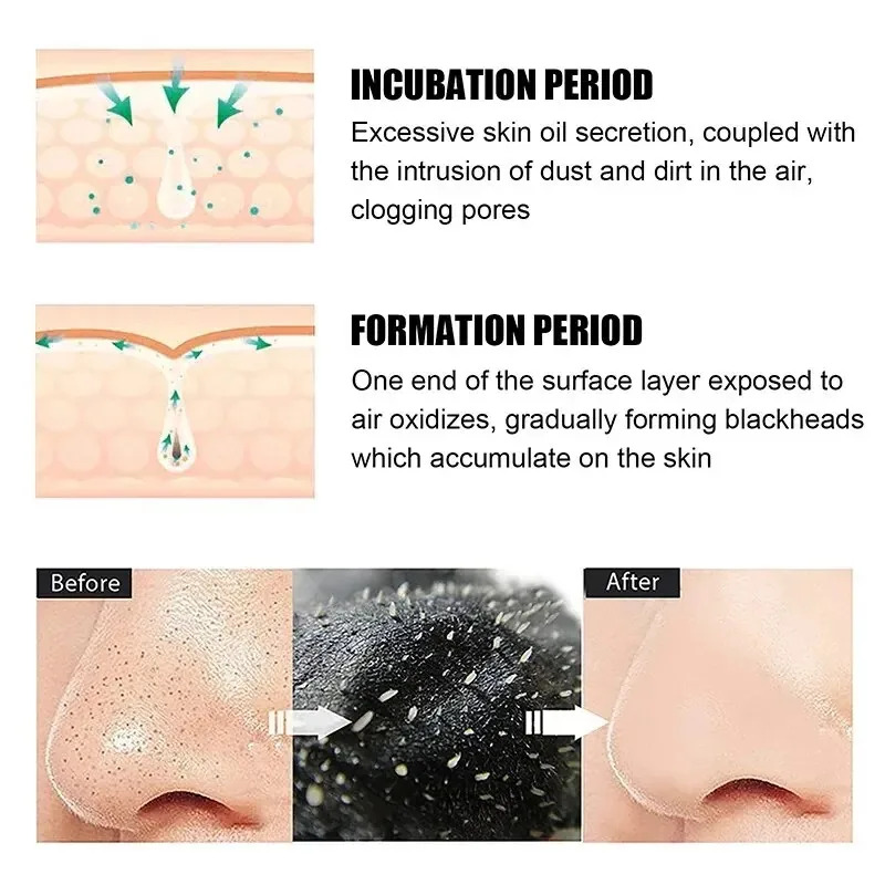 10/150 Pezzi Maschera Rimuovi  - Skincare Finally Found You recensione e prezzo